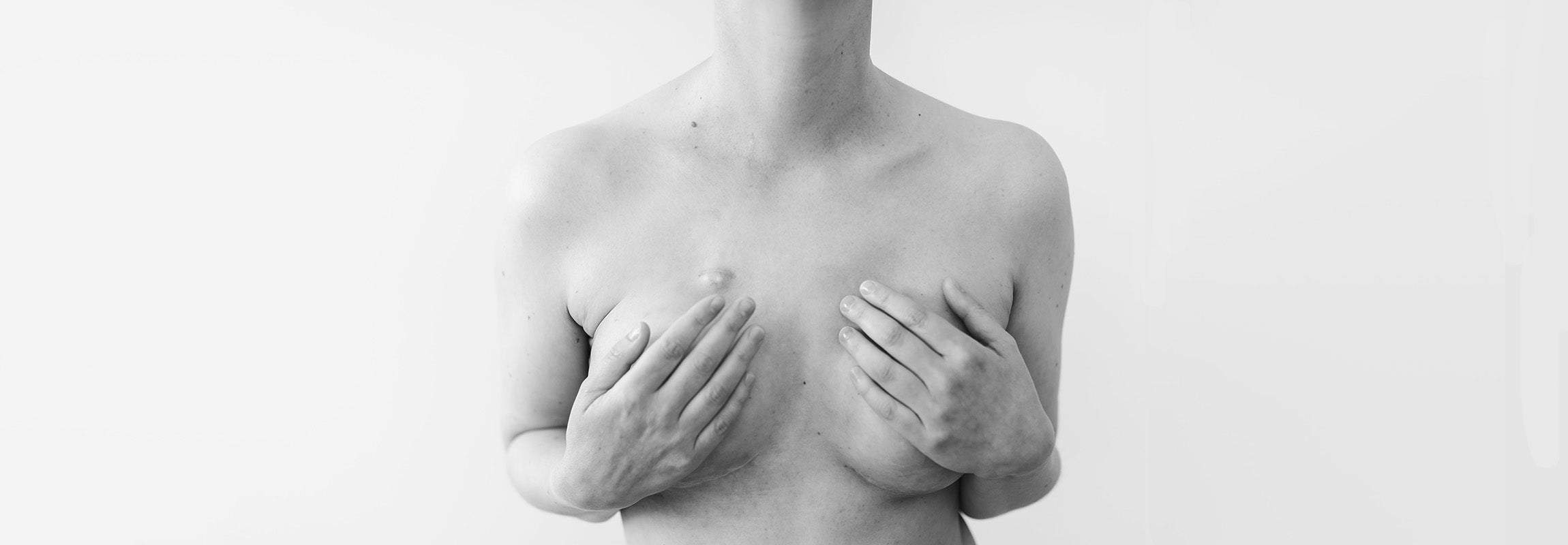 Why Breast Cancer Screening Guidelines Need Rethinking