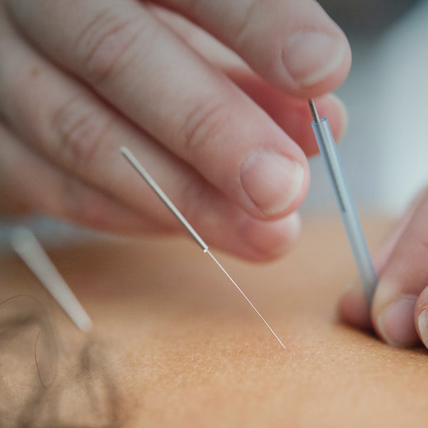 Easing Side Effects: Acupuncture & Cancer Treatment