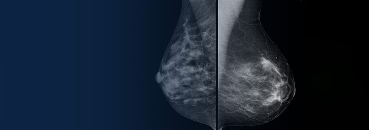 World Health Day: Innovations in Breast Cancer Detection & Treatment